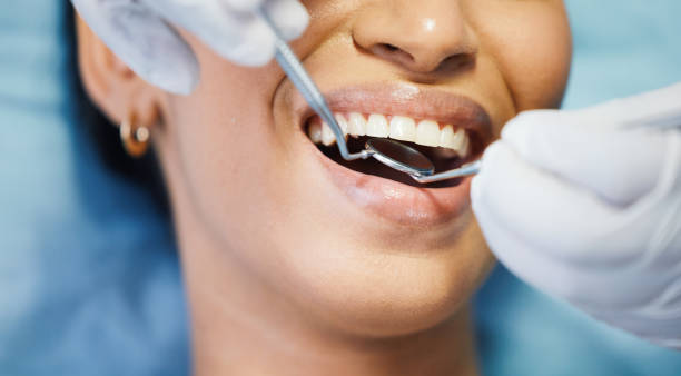 Best Emergency Dentist for Knocked-Out Tooth in Barrington Hls, IL
